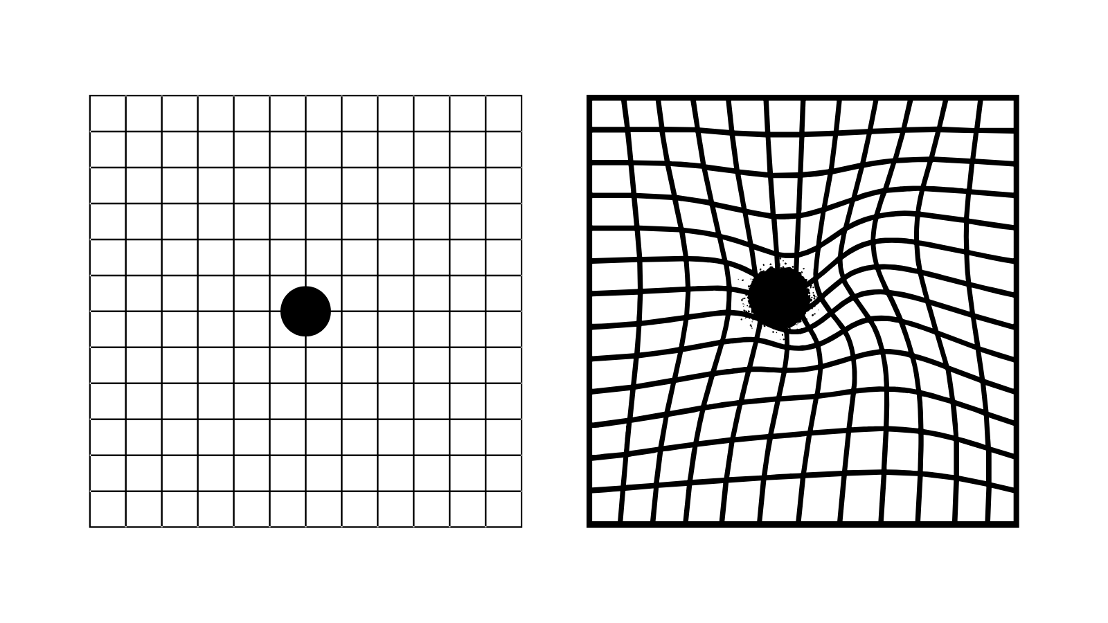 Amsler grid - normal and distorted 
