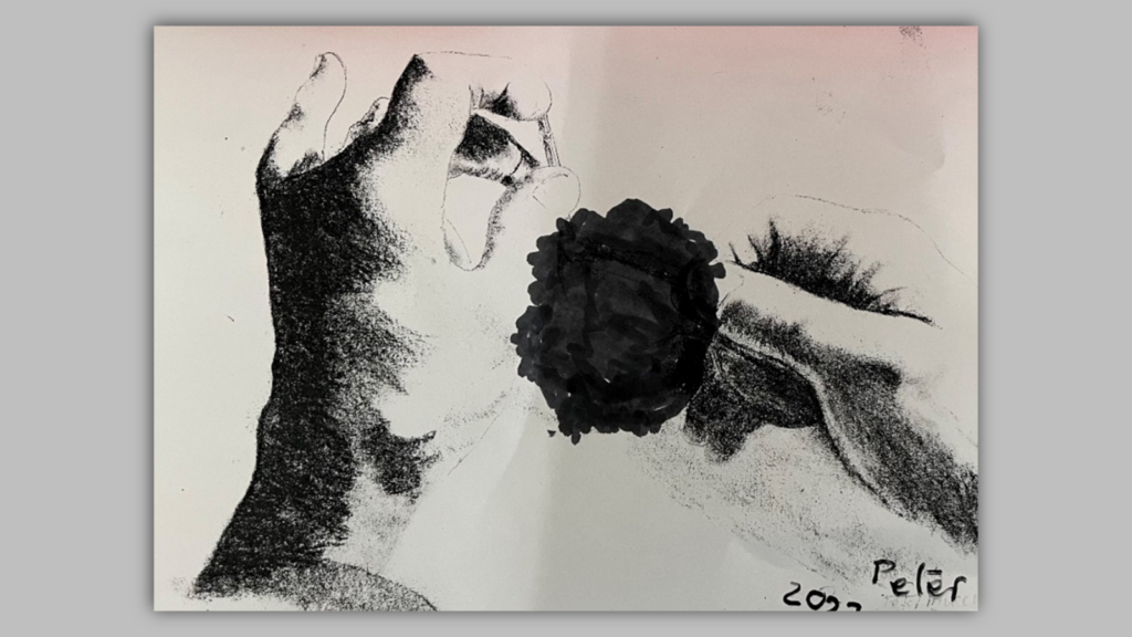 Drawing of artist depicting black spot caused by AMD